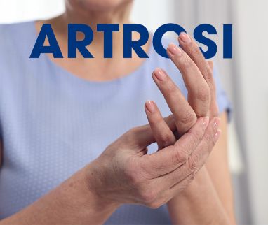 L’artrosi è una malattia articolare degenerativa molto comune: colpisce circa 600 milioni di persone nel mondo e oltre 1,2 milioni in Svizzera